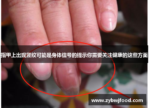 指甲上出现竖纹可能是身体信号的提示你需要关注健康的这些方面